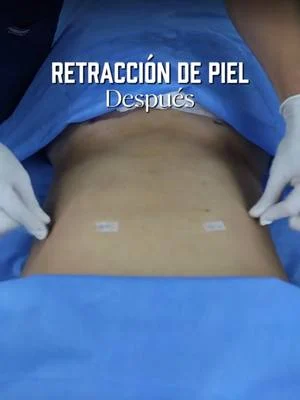 👨🏻‍⚕️El 𝗗𝗿. 𝗘𝗱𝘂𝗮𝗿𝗱𝗼 𝗣𝗲́𝗿𝗲𝘇 te lo explica: ¿𝗣𝗶𝗲𝗹 𝗳𝗹𝗮́𝗰𝗶𝗱𝗮?