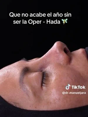 Con un anariz opera-hada🧚 #peru🇵🇪 #lima #hadas🧚‍♀️ #hadas #viralvideos #rinoplastia #trendd